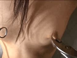 Twisted nipples'